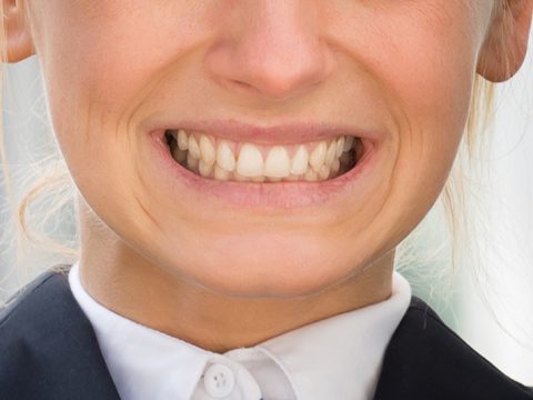 woman grinding teeth bruxism