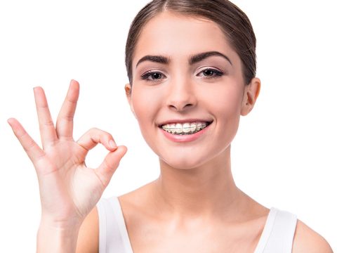 woman with white clear ceramic braces