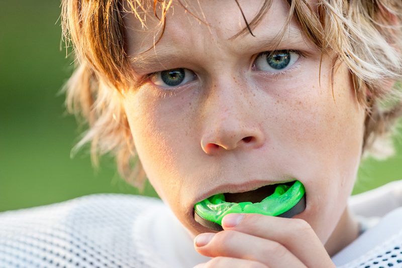 Sports Mouthguards Knollwood Dental Care